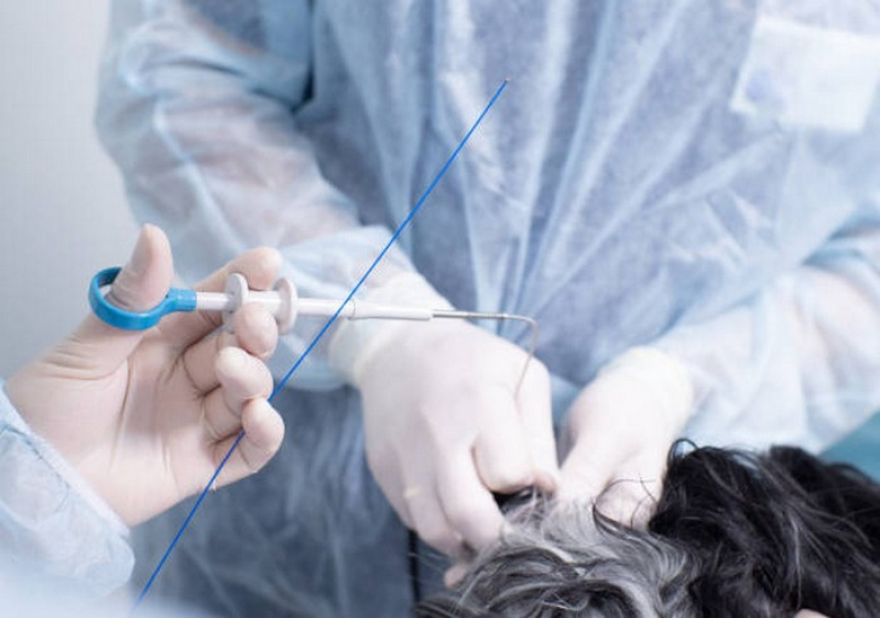 Onde Fazer Cirurgia de Castração em Cachorro Silvanópolis - Cirurgia Castração Gato